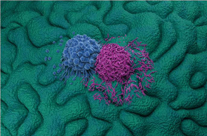 Gastric cancer cells.